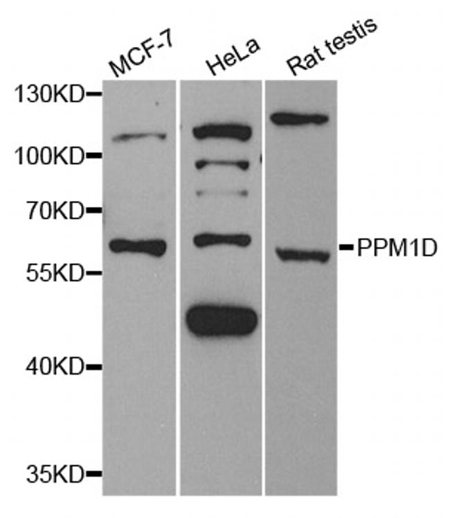 PPM1D Antibody in Western Blot (WB)