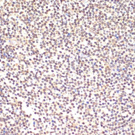 TIA-1 Antibody in Immunohistochemistry (Paraffin) (IHC (P))