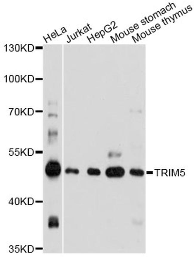 TRIM5 alpha/gamma/delta Antibody in Western Blot (WB)
