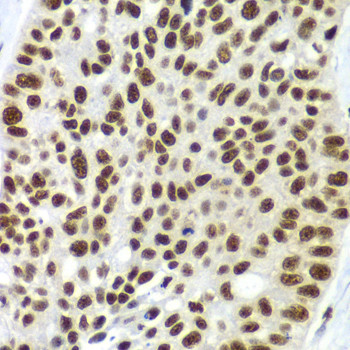 SF3B2 Antibody in Immunohistochemistry (Paraffin) (IHC (P))