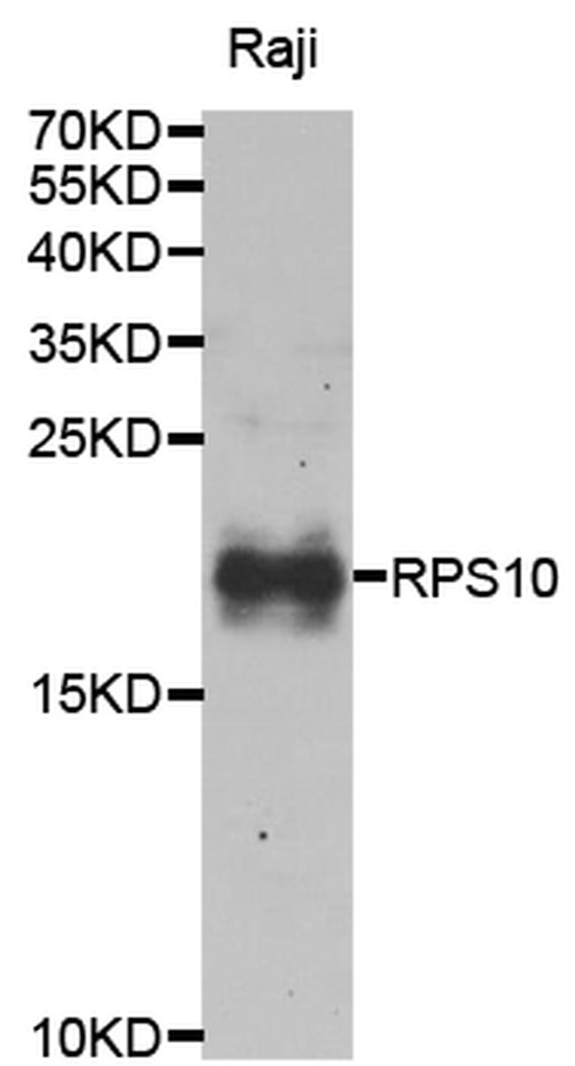 RPS10 Antibody in Western Blot (WB)