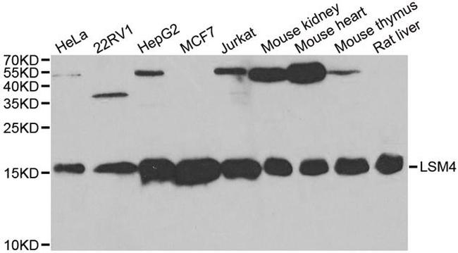 LSM4 Antibody in Western Blot (WB)