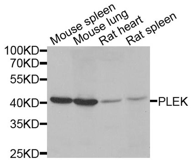 Pleckstrin Antibody in Western Blot (WB)