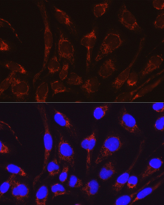 CAT1 Antibody in Immunocytochemistry (ICC/IF)