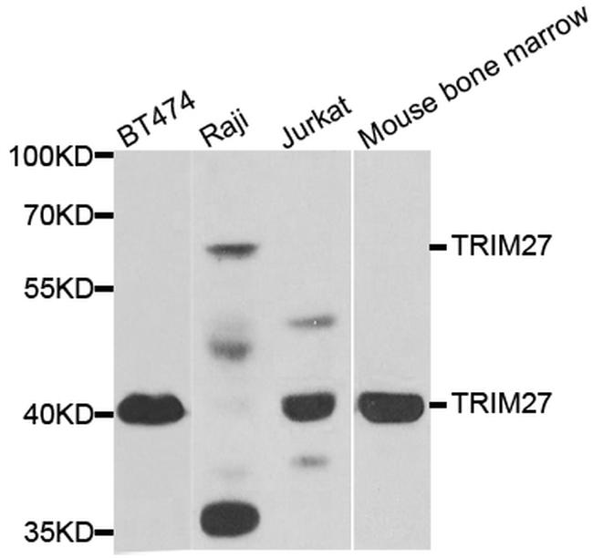 TRIM27 Antibody in Western Blot (WB)