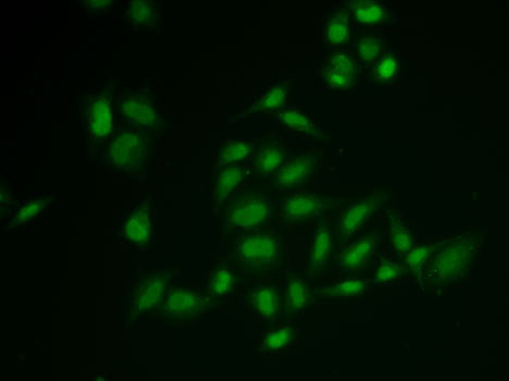 SSRP1 Antibody in Immunocytochemistry (ICC/IF)