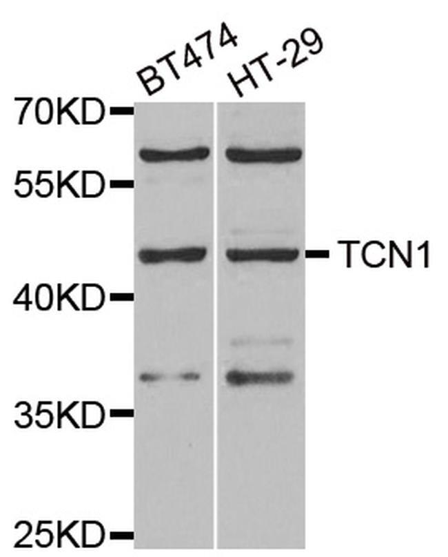 TCN1 Antibody in Western Blot (WB)