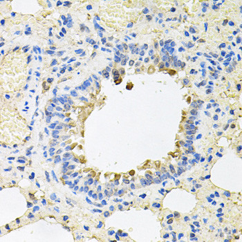 SKAP2 Antibody in Immunohistochemistry (Paraffin) (IHC (P))