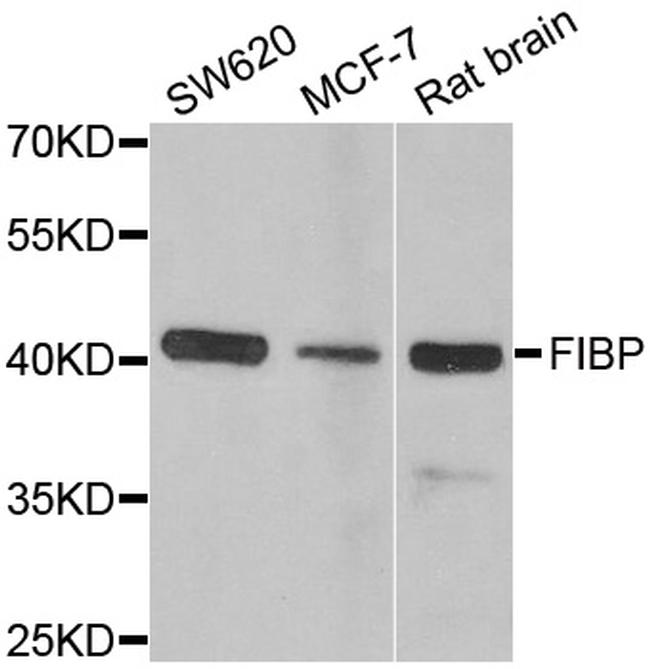 FIBP Antibody in Western Blot (WB)