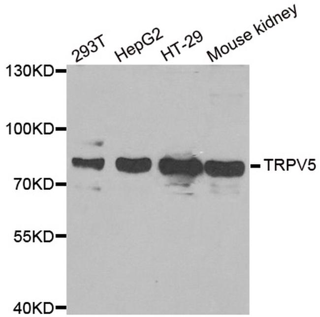 TRPV5 Antibody in Western Blot (WB)
