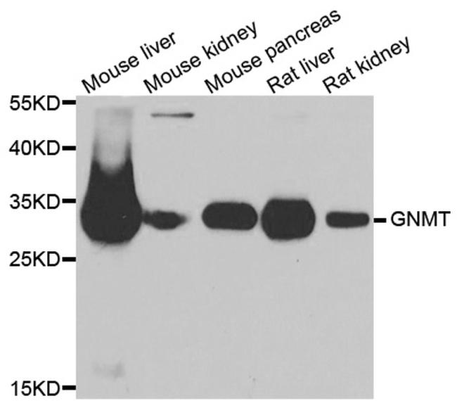 GNMT Antibody in Western Blot (WB)