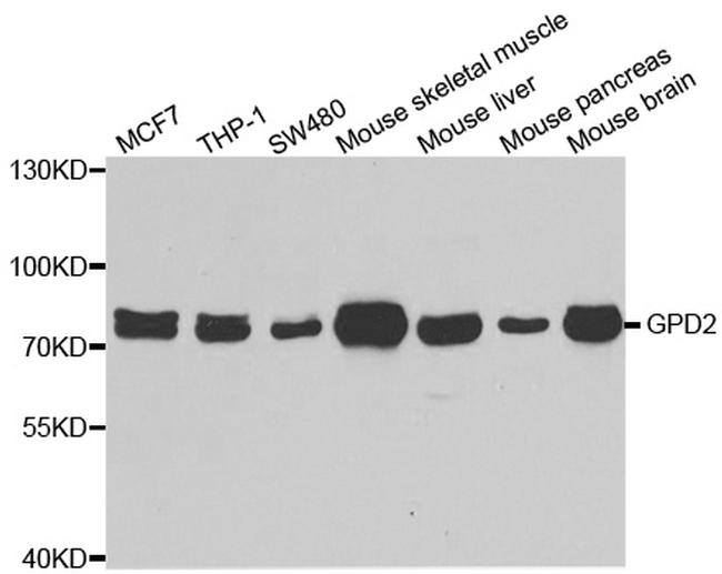 GPD2 Antibody in Western Blot (WB)