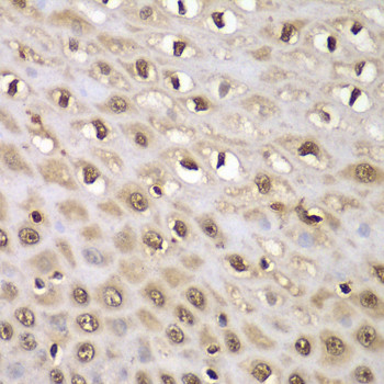 INTS5 Antibody in Immunohistochemistry (Paraffin) (IHC (P))
