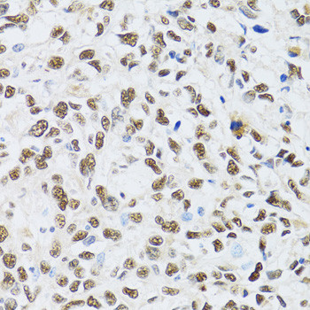 MTA3 Antibody in Immunohistochemistry (Paraffin) (IHC (P))