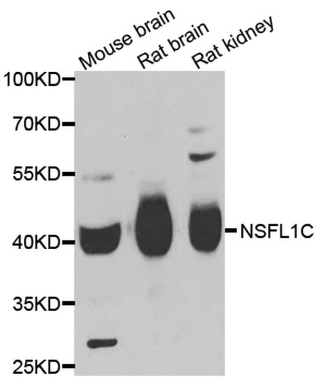 NSFL1C Antibody in Western Blot (WB)