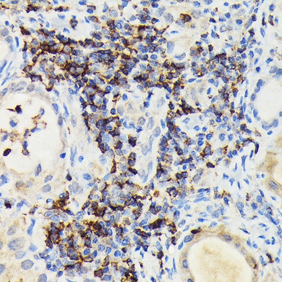 PIK3CG Antibody in Immunohistochemistry (Paraffin) (IHC (P))