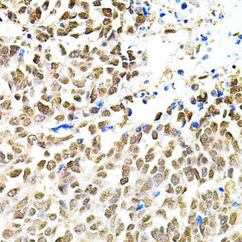 PNK Antibody in Immunohistochemistry (Paraffin) (IHC (P))