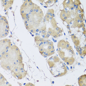 RPLP1 Antibody in Immunohistochemistry (Paraffin) (IHC (P))
