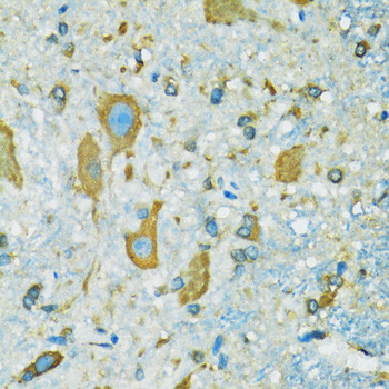 RPS7 Antibody in Immunohistochemistry (Paraffin) (IHC (P))