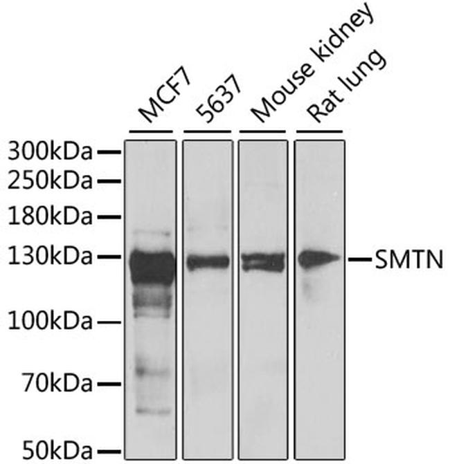 Smoothelin Antibody in Western Blot (WB)