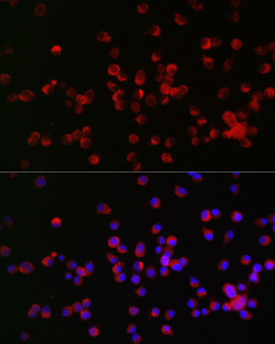 Nogo Receptor Antibody in Immunocytochemistry (ICC/IF)