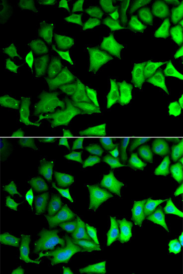 RPS12 Antibody in Immunocytochemistry (ICC/IF)