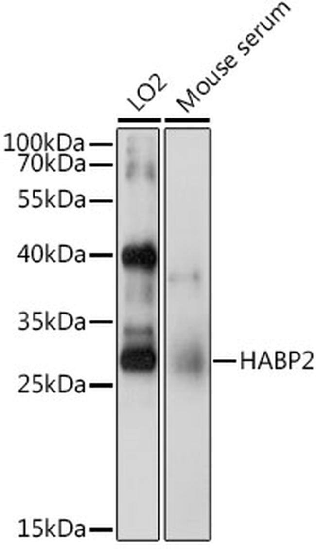 HABP2 Antibody in Western Blot (WB)