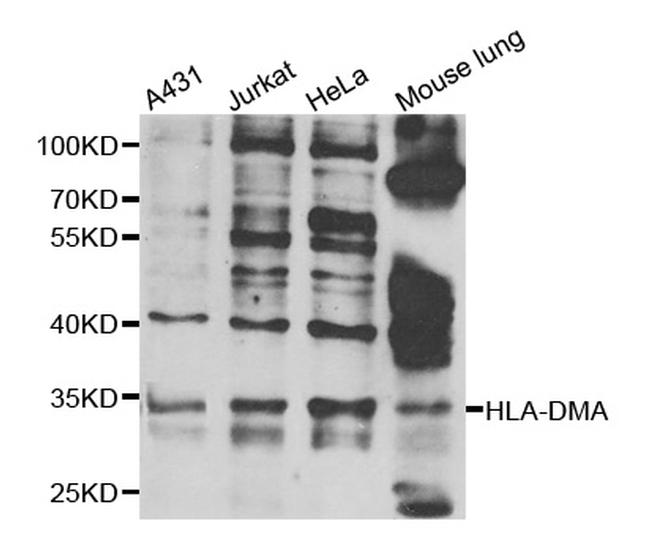 HLA-DMA Antibody in Western Blot (WB)