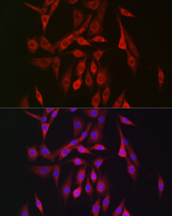 AMPK beta-2 Antibody in Immunocytochemistry (ICC/IF)