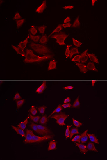 Chemerin Antibody in Immunocytochemistry (ICC/IF)