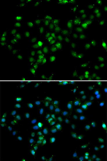 RBBP6 Antibody in Immunocytochemistry (ICC/IF)