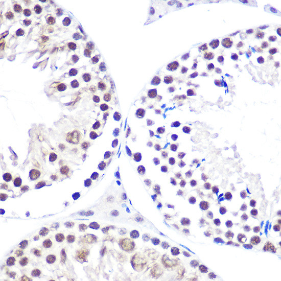 RDBP Antibody in Immunohistochemistry (Paraffin) (IHC (P))