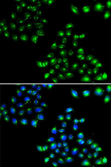 COPB2 Antibody in Immunocytochemistry (ICC/IF)