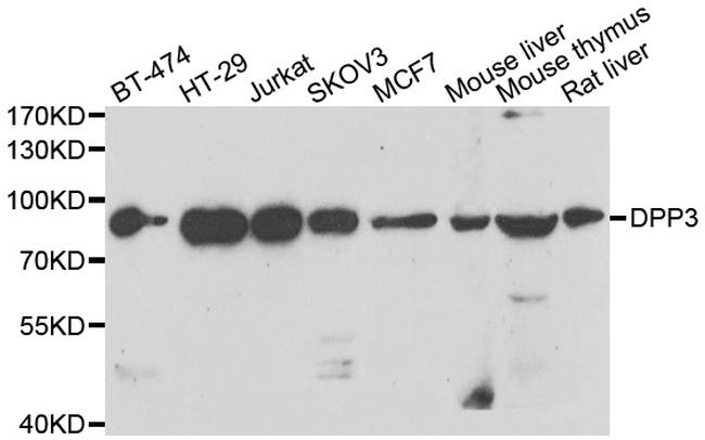 DPP3 Antibody in Western Blot (WB)