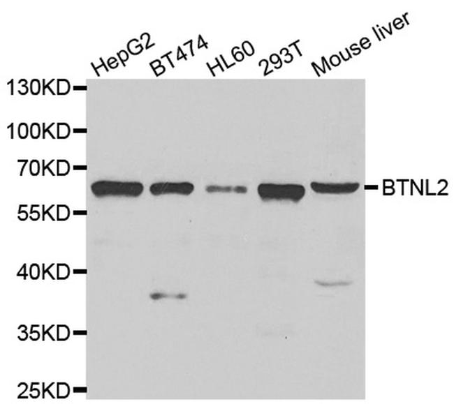 BTNL2 Antibody in Western Blot (WB)