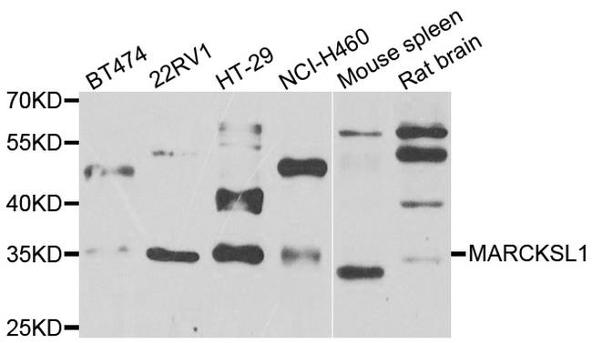 MARCKSL1 Antibody in Western Blot (WB)