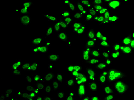 FIP1L1 Antibody in Immunocytochemistry (ICC/IF)