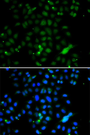 ELF4 Antibody in Immunocytochemistry (ICC/IF)
