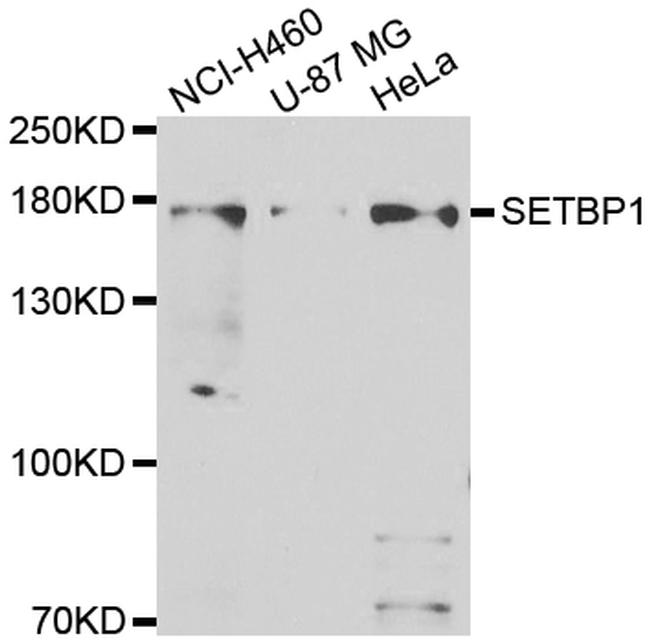 SETBP1 Antibody in Western Blot (WB)