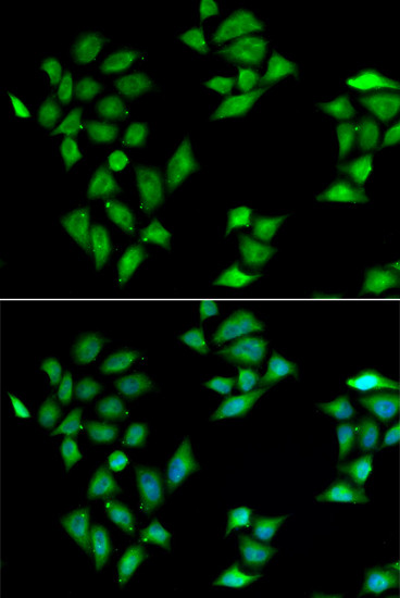ITLN1 Antibody in Immunocytochemistry (ICC/IF)