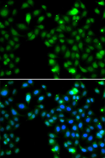 ING5 Antibody in Immunocytochemistry (ICC/IF)