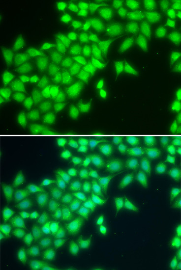 METTL2 Antibody in Immunocytochemistry (ICC/IF)