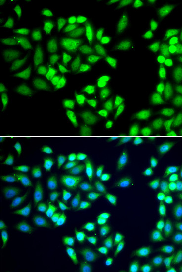 SGTA Antibody in Immunocytochemistry (ICC/IF)