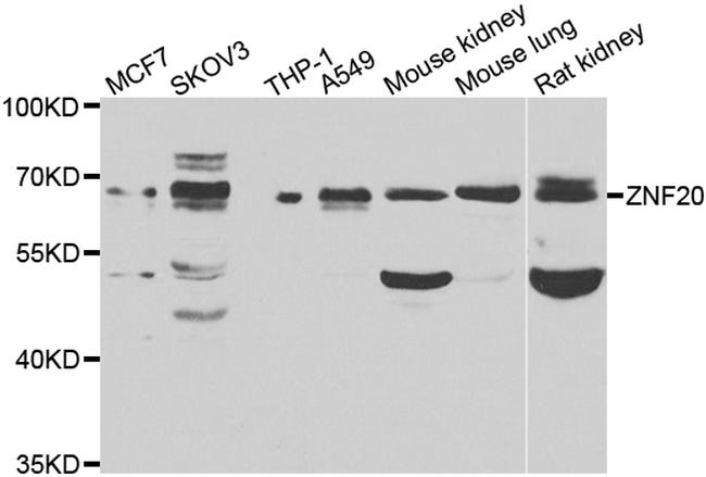 ZNF20 Antibody in Western Blot (WB)