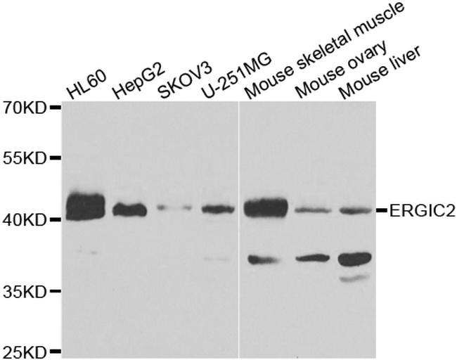 ERGIC2 Antibody in Western Blot (WB)