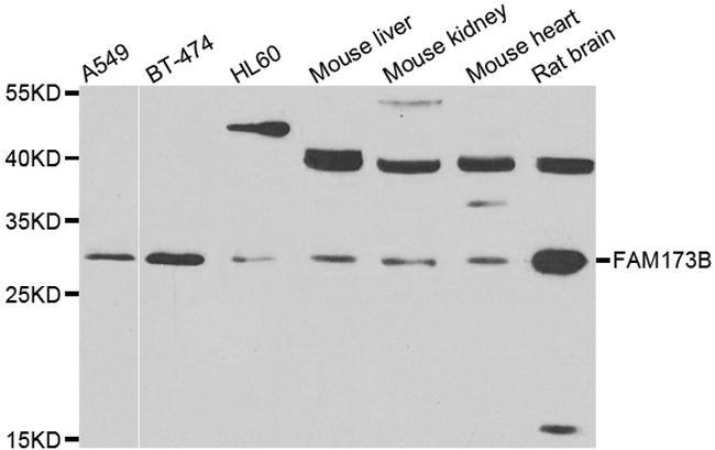 FAM173B Antibody in Western Blot (WB)
