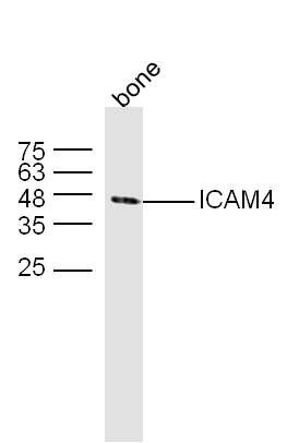 ICAM-4 Antibody in Western Blot (WB)