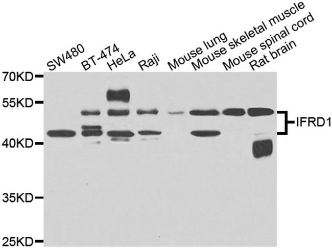 IFRD1 Antibody in Western Blot (WB)