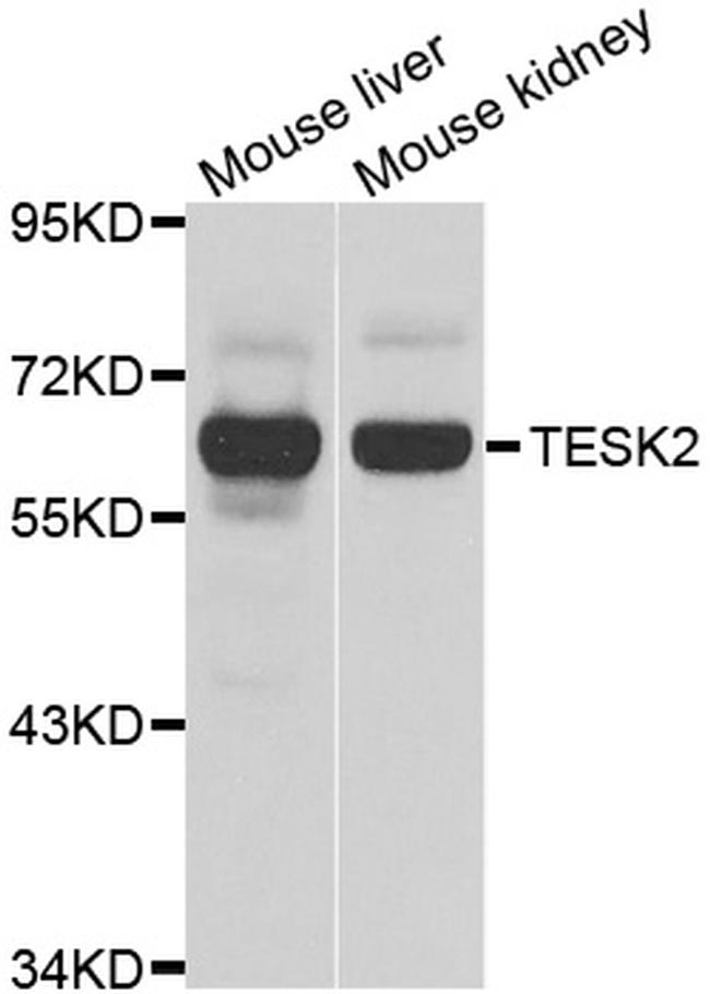 TESK2 Antibody in Western Blot (WB)