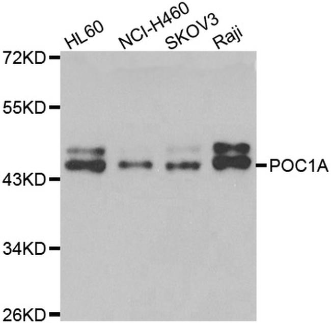 POC1A Antibody in Western Blot (WB)
